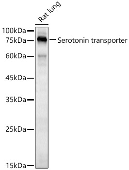 Rabbit anti-SLC6A4 Polyclonal Antibody
