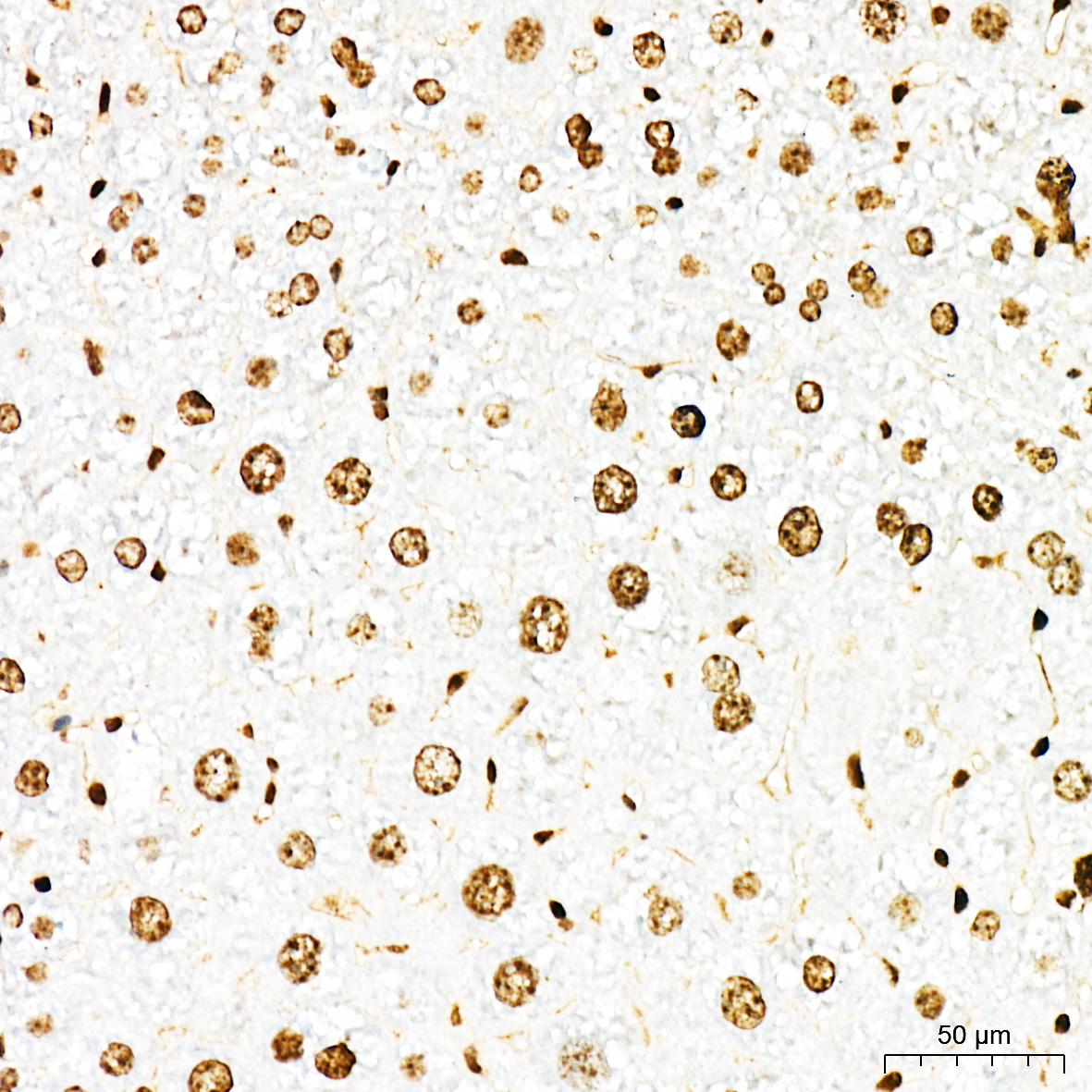 Rabbit anti-HMGB1 Polyclonal Antibody