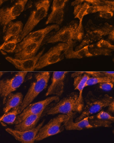 Rabbit anti-BRPF1 Polyclonal Antibody