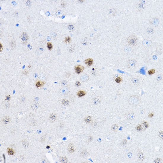 Rabbit anti-RPP25 Polyclonal Antibody