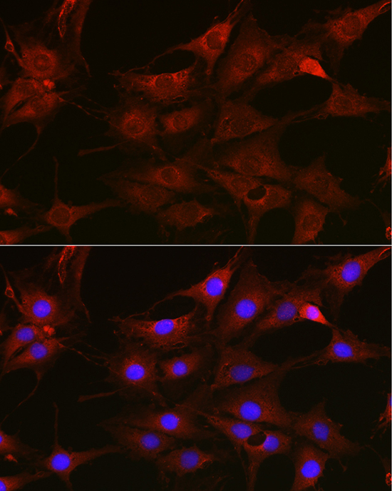 Rabbit anti-RAC1/2/3 Polyclonal Antibody