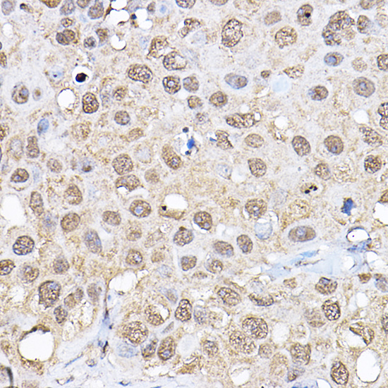 Rabbit anti-RPS6KB1 Polyclonal Antibody