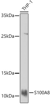 Rabbit anti-S100A8 Polyclonal Antibody