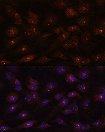 Rabbit anti-RNASEH2A Polyclonal Antibody