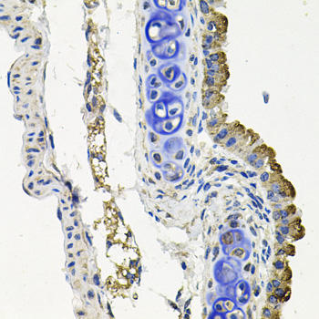 Rabbit anti-MARK1 Polyclonal Antibody
