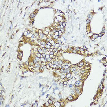 Rabbit anti-SOCS6 Polyclonal Antibody