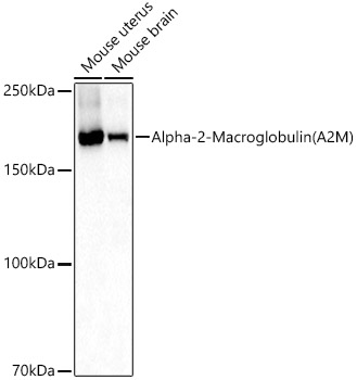 Rabbit anti-A2M Polyclonal Antibody