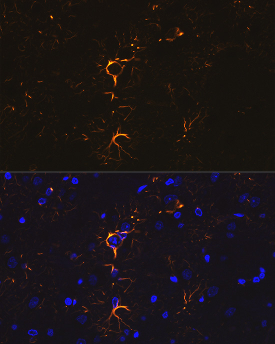 Rabbit anti-GFAP Polyclonal Antibody