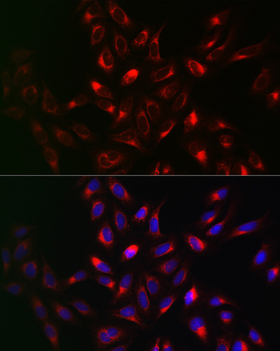 Rabbit anti-VAPB Polyclonal Antibody