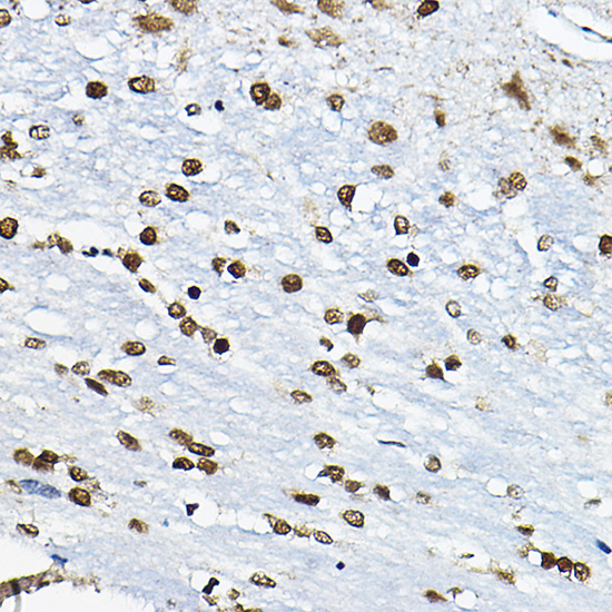 Rabbit anti-CIRBP Polyclonal Antibody