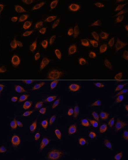 Rabbit anti-NTPCR Polyclonal Antibody