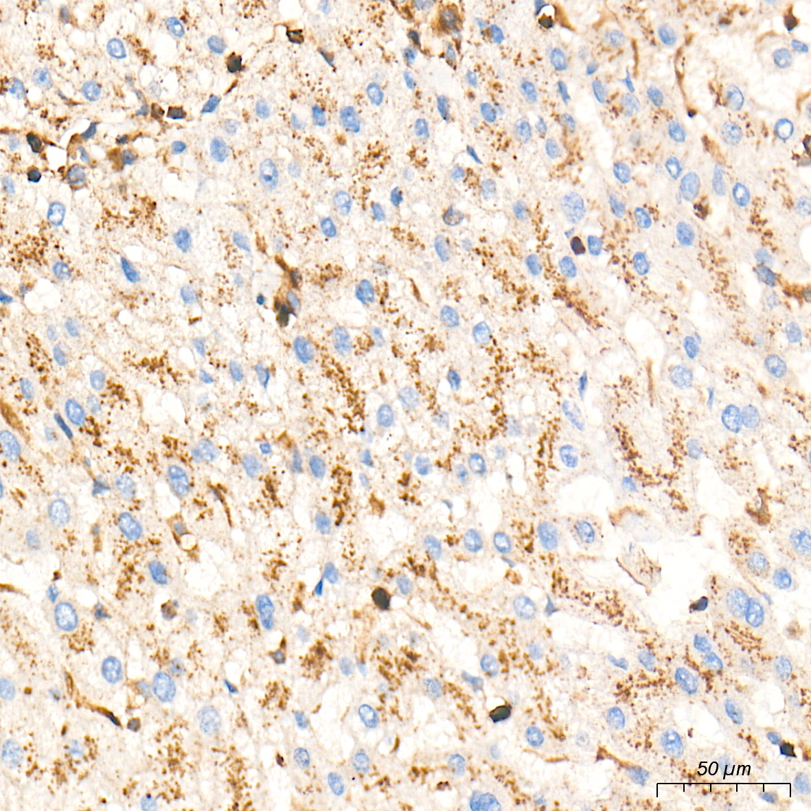 Rabbit anti-AGTRAP Polyclonal Antibody