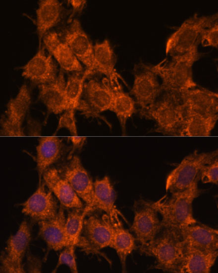 Rabbit anti-SNX15 Polyclonal Antibody
