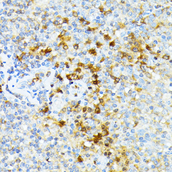 Rabbit anti-SPTA1 Polyclonal Antibody