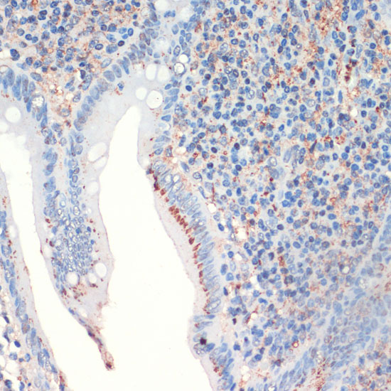 Rabbit anti-SST Polyclonal Antibody
