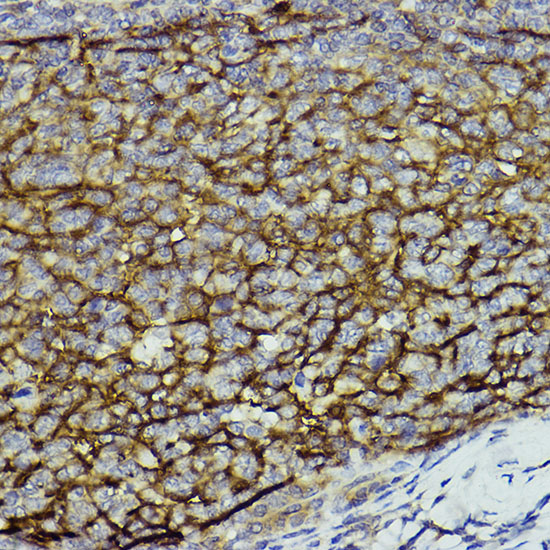 Rabbit anti-ITGAM Polyclonal Antibody