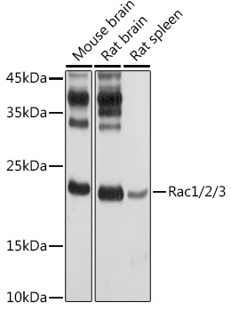 Rabbit anti-RAC1/2/3 Polyclonal Antibody