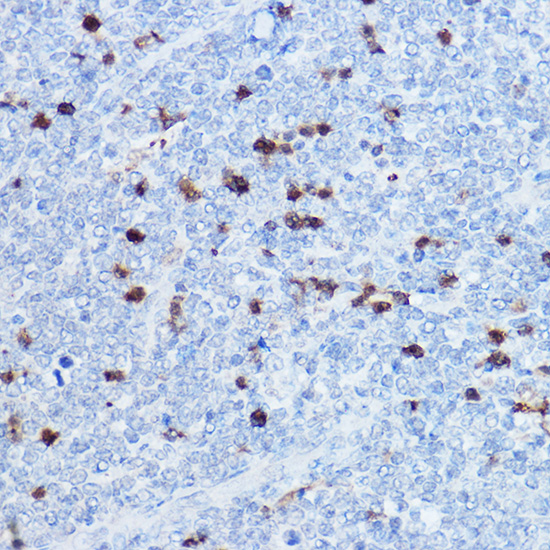 Rabbit anti-S100A8 Polyclonal Antibody