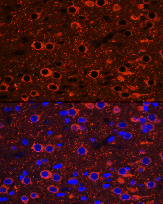 Rabbit anti-βIII-Tubulin Polyclonal Antibody