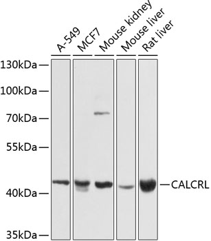 Rabbit anti-CALCRL Polyclonal Antibody