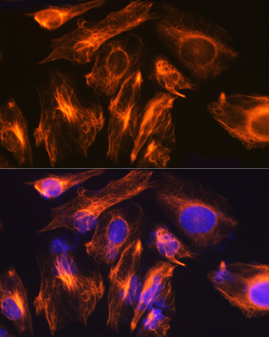 Rabbit anti-GFAP Polyclonal Antibody