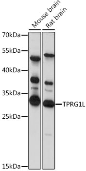 Rabbit anti-TPRG1L Polyclonal Antibody