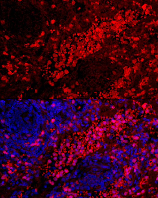 Rabbit anti-S100A12 Polyclonal Antibody