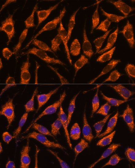 Rabbit anti-SNX15 Polyclonal Antibody