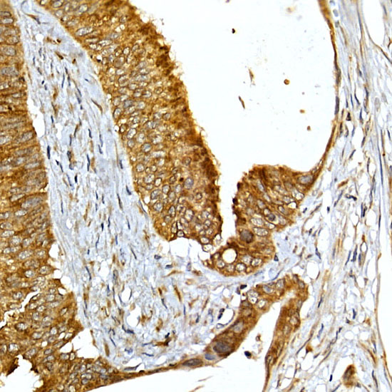 Rabbit anti-VAPB Polyclonal Antibody