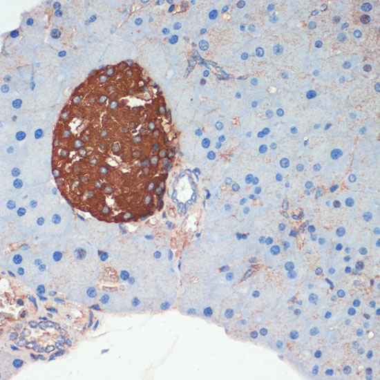 Rabbit anti-SST Polyclonal Antibody