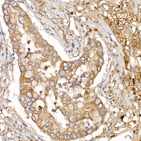 Rabbit anti-NUMB Polyclonal Antibody