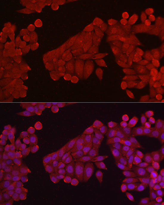 Rabbit anti-HK3 Polyclonal Antibody