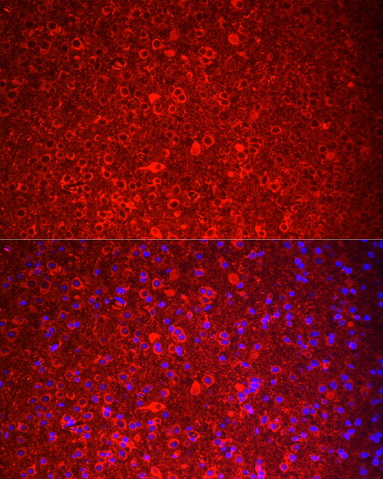 Rabbit anti-TAC3 Polyclonal Antibody