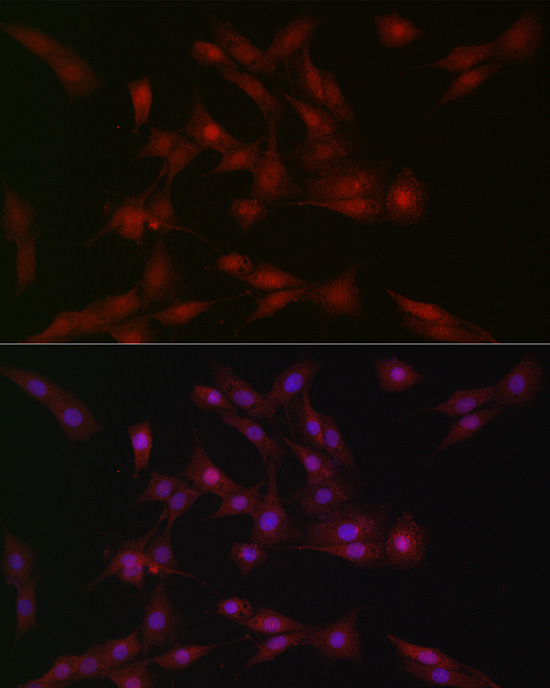 Rabbit anti-SOCS1 Polyclonal Antibody