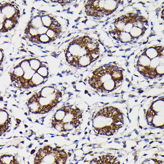 Rabbit anti-MAOB Polyclonal Antibody