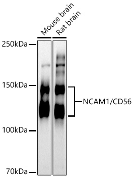 Rabbit anti-NCAM1 Polyclonal Antibody