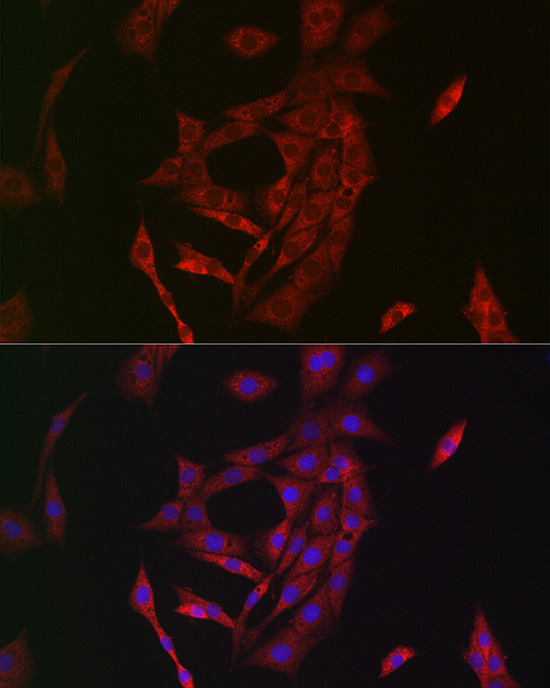 Rabbit anti-TGM2 Polyclonal Antibody