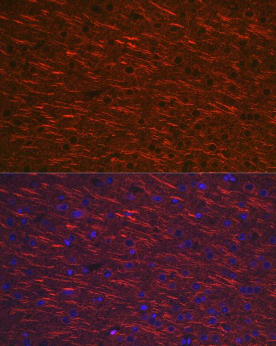 Rabbit anti-MAP2 Polyclonal Antibody