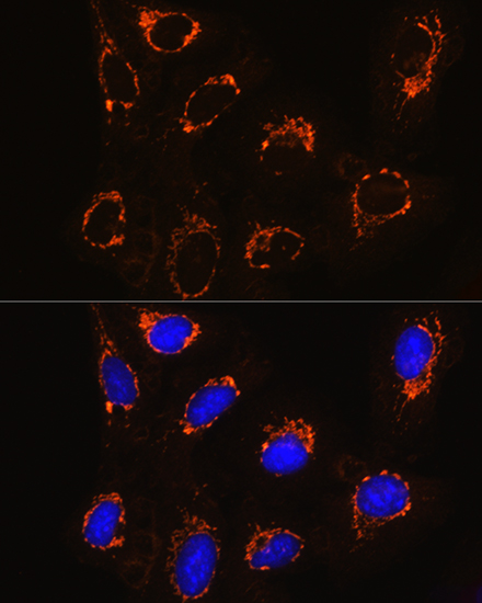 Rabbit anti-MAOB Polyclonal Antibody