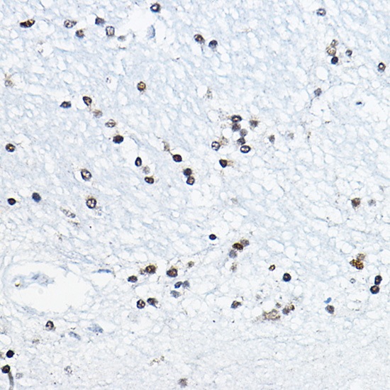 Rabbit anti-CIRBP Polyclonal Antibody