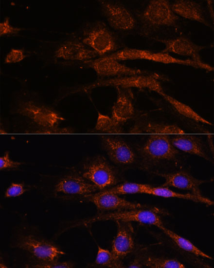 Rabbit anti-AP3S2 Polyclonal Antibody