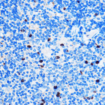 Rabbit anti-CHEK1 Polyclonal Antibody