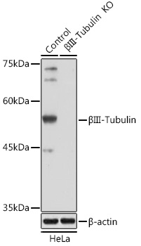 Rabbit anti-βIII-Tubulin Polyclonal Antibody