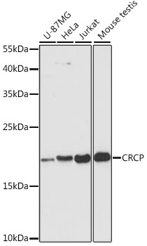 Rabbit anti-CRCP Polyclonal Antibody