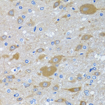 Rabbit anti-EIF2S3 Polyclonal Antibody