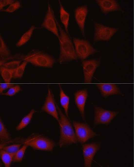 Rabbit anti-TGFBI Polyclonal Antibody