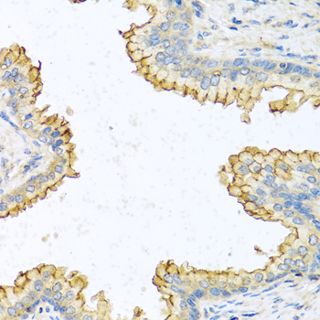 Rabbit anti-RNASE13 Polyclonal Antibody