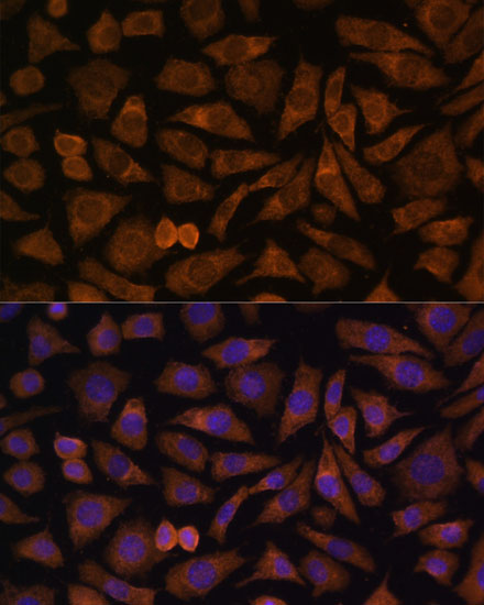 Rabbit anti-RABIF Polyclonal Antibody