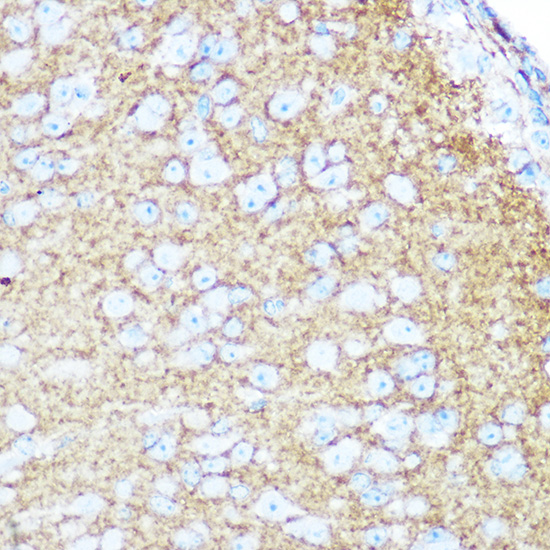Rabbit anti-NCAM1 Polyclonal Antibody