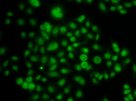 Rabbit anti-ATOH7 Polyclonal Antibody
